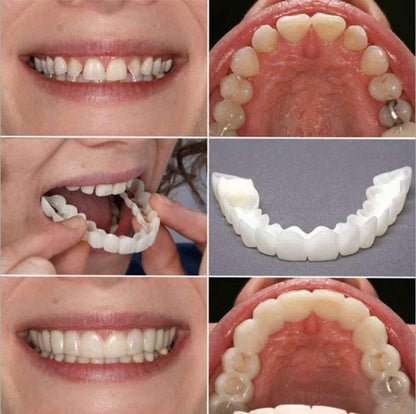 ✨ Instant Perfect Smile Veneers – Snap-On Teeth ✨