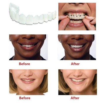 ✨ Instant Perfect Smile Veneers – Snap-On Teeth ✨